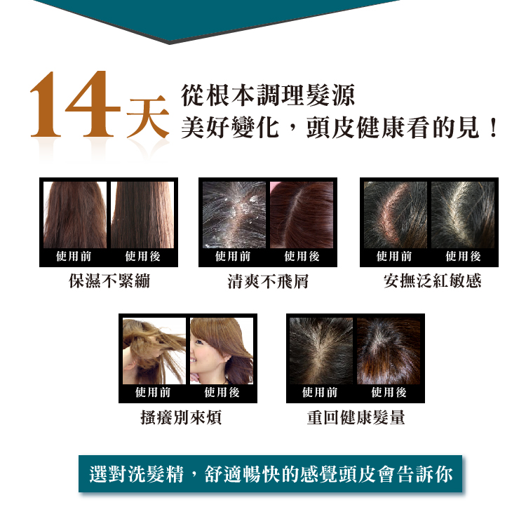 1574068167635708.jpg 植淨林舒敏強健洗髮-文案(調)_11.jpg