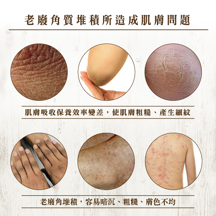 1574127216110070.jpg gp_去角質內頁-老廢角質.jpg